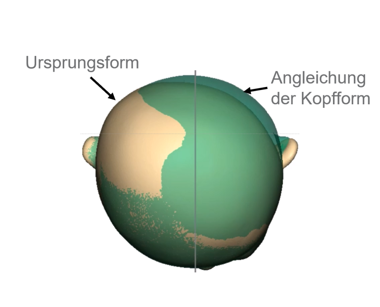 Digitale Überlagerung von Modellen, Kontrolle Körpermodellierung, Digitale Modellierung Orthopädietechnik